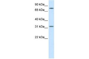 Image no. 1 for anti-Wingless-Type MMTV Integration Site Family, Member 8B (WNT8B) (Middle Region) antibody (ABIN2777967)