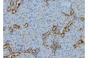 Image no. 2 for anti-Cathepsin S (CTSS) (Internal Region) antibody (ABIN6261104)