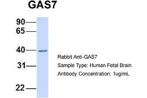 Image no. 2 for anti-Growth Arrest-Specific 7 (GAS7) (N-Term) antibody (ABIN2783125)