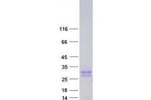 Image no. 1 for CD99 Molecule-Like 2 (CD99L2) (Transcript Variant 4) protein (Myc-DYKDDDDK Tag) (ABIN2713825)