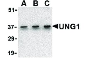 Image no. 1 for anti-Uracil-DNA Glycosylase (UNG) (C-Term) antibody (ABIN6657334)