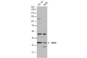 Image no. 1 for anti-Aryl Hydrocarbon Receptor Interacting Protein (AIP) (Center) antibody (ABIN2856771)