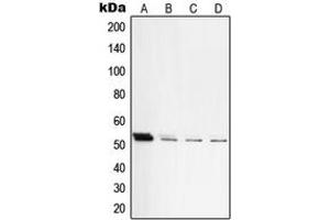 Image no. 2 for anti-Protein Kinase, CAMP Dependent, Catalytic, beta (PRKACB) (C-Term) antibody (ABIN2705129)