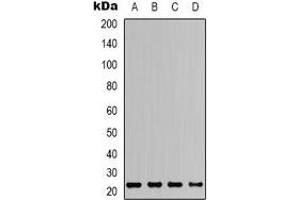 Image no. 2 for anti-Steroid Sulfatase (STS) (N-Term) antibody (ABIN2957864)