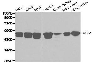 Image no. 1 for anti-serum/glucocorticoid Regulated Kinase 1 (SGK1) antibody (ABIN3021291)