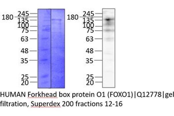 FOXO1 Protein (AA 1-655) (His-Avi Tag,MBP tag)