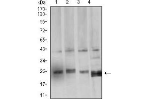 Image no. 5 for anti-BCL2-Like 2 (BCL2L2) (AA 6-118) antibody (ABIN5611241)