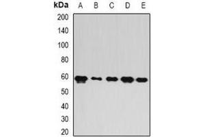 Image no. 3 for anti-FERM, RhoGEF and Pleckstrin Domain Protein 2 (FARP2) antibody (ABIN2966640)