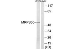 Image no. 1 for anti-Mitochondrial Ribosomal Protein S30 (MRPS30) (AA 390-439) antibody (ABIN1535025)
