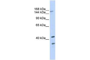 Image no. 2 for anti-ATP-Binding Cassette, Sub-Family C (CFTR/MRP), Member 8 (ABCC8) (N-Term) antibody (ABIN2781496)