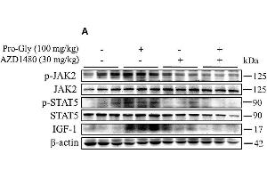 Image no. 5 for anti-Janus Kinase 2 (JAK2) (pTyr1007), (pTyr1008) antibody (ABIN740955)