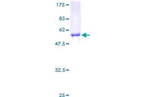 NNMT Protein (Nicotinamide N-Methyltransferase) (AA 1-264) (GST tag)