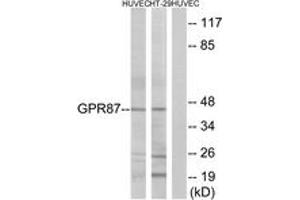 Image no. 1 for anti-G Protein-Coupled Receptor 87 (GPR87) (AA 221-270) antibody (ABIN1535752)