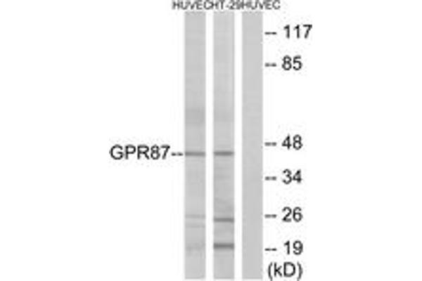 anti-G Protein-Coupled Receptor 87 (GPR87) (AA 221-270) antibody