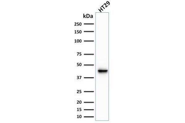 anti-Keratin 20 (KRT20) (AA 196-323) antibody