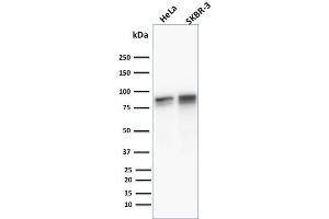Image no. 4 for anti-Junction Plakoglobin (JUP) antibody (ABIN6939838)