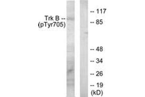 Western blot analysis of extracts from mouse kidney, using Trk B (Phospho-Tyr705) Antibody.
