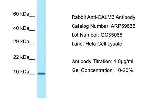 Western Blotting (WB) image for anti-Calmodulin 3 (Phosphorylase Kinase, Delta) (CALM3) (N-Term) antibody (ABIN2774263)