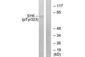 Western blot analysis of extracts from HT29 cells, using SYK (Phospho-Tyr323) Antibody.