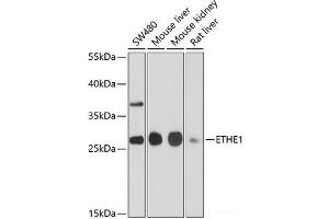 Western blot analysis of extracts of various cell lines using ETHE1 Polyclonal Antibody at dilution of 1:1000.