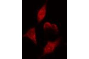 Image no. 1 for anti-Endonuclease VIII-Like 1 (NEIL1) (Internal Region) antibody (ABIN6258289)