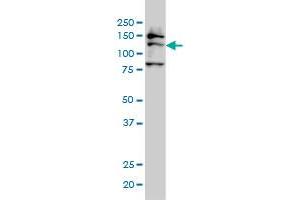 anti-Formin-Like 2 (FMNL2) (AA 1-178) antibody