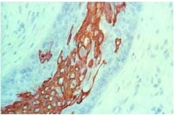 Keratin 10 antibody