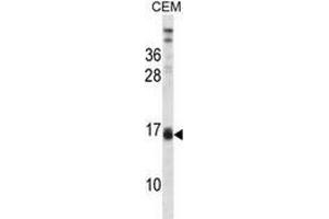 Image no. 1 for anti-Lactalbumin, alpha- (LALBA) (AA 37-68), (Middle Region) antibody (ABIN953131)