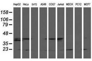 Image no. 8 for anti-LSM1 Homolog, U6 Small Nuclear RNA Associated (LSM1) antibody (ABIN1499210)