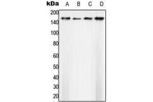 Image no. 1 for anti-Splicing Factor 3b, Subunit 1, 155kDa (SF3B1) (N-Term) antibody (ABIN2707728)