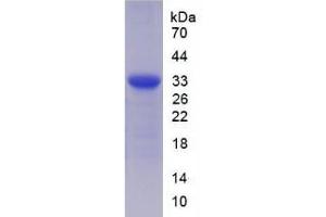 Image no. 1 for Suppression of Tumorigenicity 14 (Colon Carcinoma) (ST14) (AA 607-852) protein (His tag) (ABIN1080873)