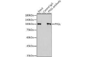 Immunoprecipitation analysis of 300 μg extracts of HeLa cells using 3 μg PYGL antibody (ABIN6132277, ABIN6146525, ABIN6146526 and ABIN6222425).