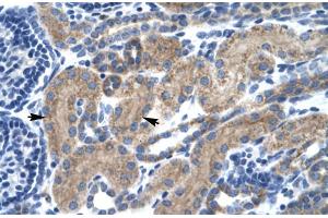 Image no. 2 for anti-Transcription Factor 7 (T-Cell Specific, HMG-Box) (TCF7) (Middle Region) antibody (ABIN2776021)