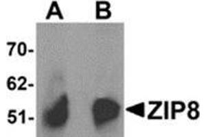 Image no. 1 for anti-Solute Carrier Family 39 (Zinc Transporter), Member 8 (SLC39A8) (C-Term) antibody (ABIN783809)