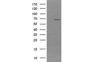 Image no. 2 for anti-NADPH Dependent Diflavin Oxidoreductase 1 (NDOR1) antibody (ABIN1499655)