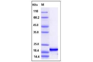 Image no. 1 for Interferon, alpha 4 (IFNa4) (AA 1-189) (Active) protein (His tag) (ABIN2002606)