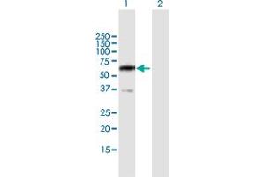 Western Blot analysis of PPP2R5B expression in transfected 293T cell line by PPP2R5B MaxPab polyclonal antibody.