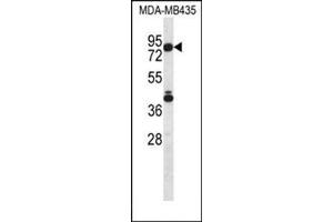 Image no. 2 for anti-Sphingosine-1-Phosphate Lyase 1 (SGPL1) (AA 79-109), (N-Term) antibody (ABIN954782)
