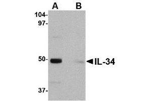 Image no. 1 for anti-Interleukin 34 (IL34) (Internal Region) antibody (ABIN342710)