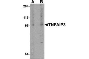 Western Blotting (WB) image for anti-Tumor Necrosis Factor, alpha-Induced Protein 3 (TNFAIP3) (Middle Region) antibody (ABIN1031138)
