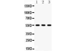 Image no. 2 for anti-Phospholipid Transfer Protein (PLTP) (AA 256-271), (Middle Region) antibody (ABIN3042820)
