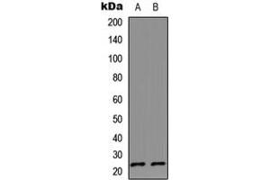 Image no. 1 for anti-Interleukin 17D (IL17D) (C-Term) antibody (ABIN2704919)