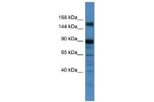 Image no. 1 for anti-Pogo Transposable Element with ZNF Domain (POGZ) (C-Term) antibody (ABIN927770)