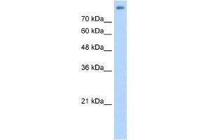 Image no. 1 for anti-Arachidonate 15-Lipoxygenase B (ALOX15B) (C-Term) antibody (ABIN2777053)