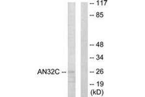 Image no. 1 for anti-Acidic (Leucine-Rich) Nuclear phosphoprotein 32 Family, Member C (ANP32C) (AA 121-170) antibody (ABIN1533505)