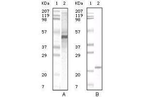 Image no. 2 for anti-Apolipoprotein A-V (APOA5) antibody (ABIN1724647)