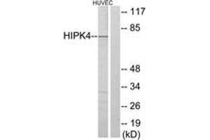 Image no. 1 for anti-Homeodomain Interacting Protein Kinase 4 (HIPK4) (AA 511-560) antibody (ABIN1534004)