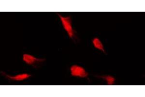 Image no. 2 for anti-Histone Deacetylase 4 (HDAC4) (pSer632) antibody (ABIN6256389)