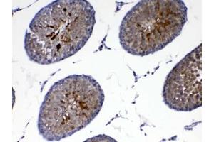 Image no. 3 for anti-Parkinson Protein 7 (PARK7) antibody (ABIN5647859)