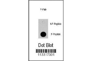 Image no. 1 for anti-Phosphoinositide-3-Kinase, Catalytic, delta Polypeptide (PIK3CD) (pTyr524) antibody (ABIN389848)